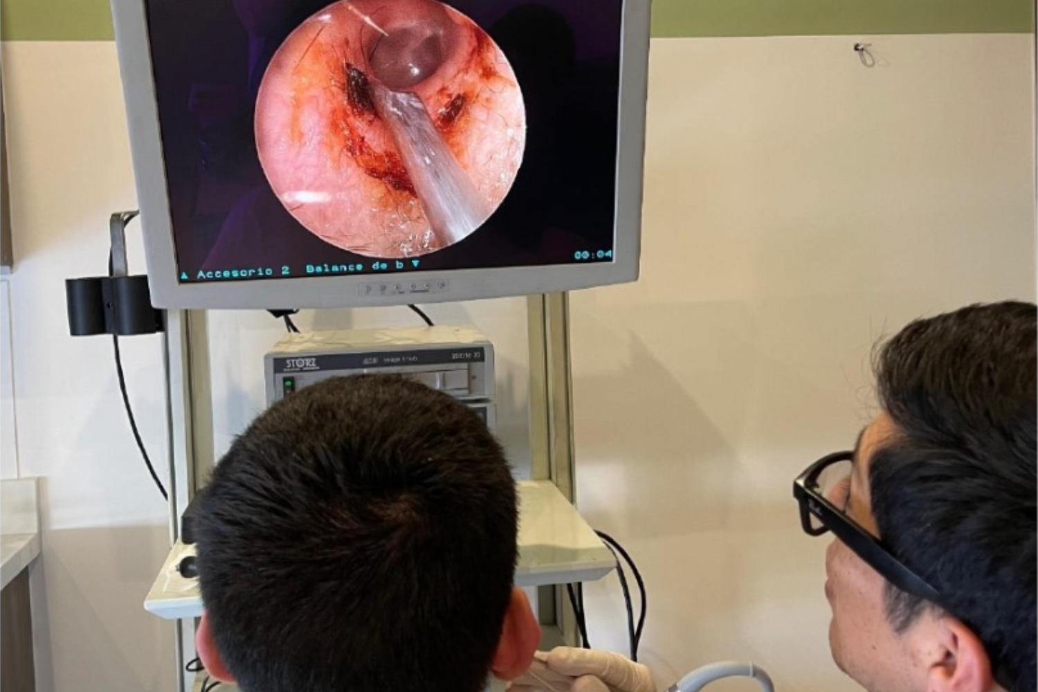 Limpieza de oído endoscópica