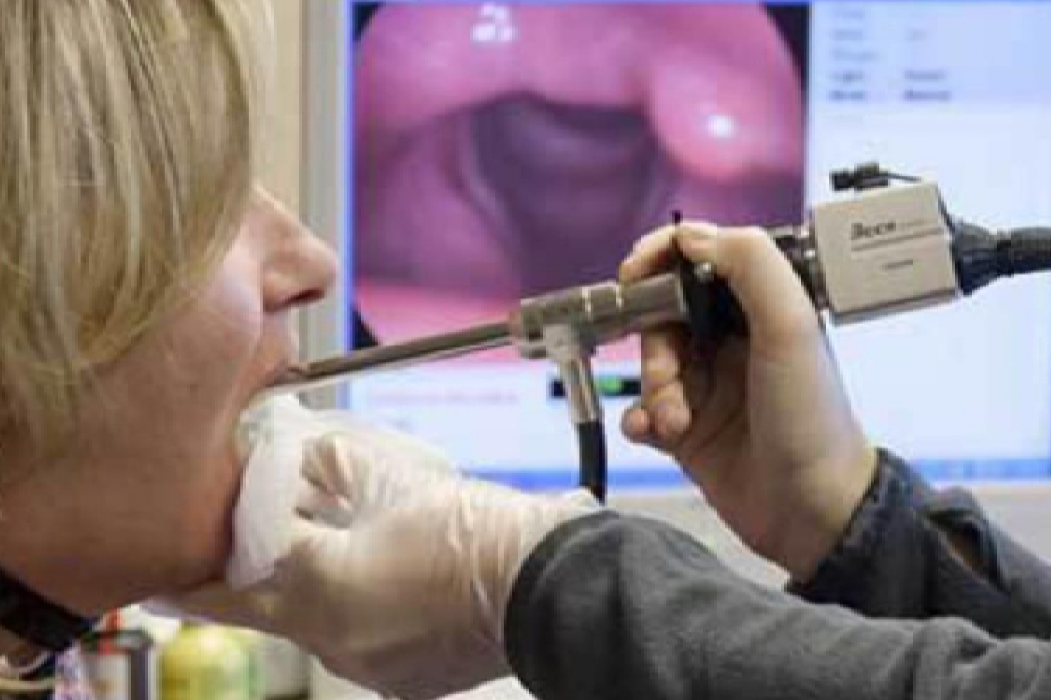 Endoscopia laríngea